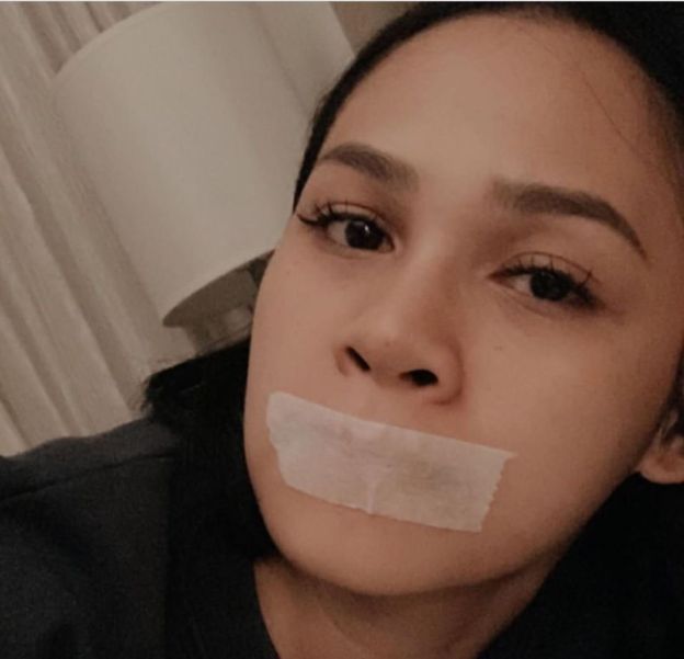 ممثلة إندونيسية تغلق فمها في أثناء النوم تثير لغطاً طبياً