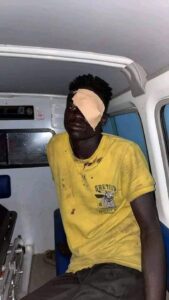 ثائر يفقد عينه أثناء مشاركته في مواكب 6 أبريل بأم درمان
