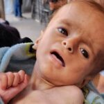 أوتشا): الحرمان جماعي وأطفال غزة جياع