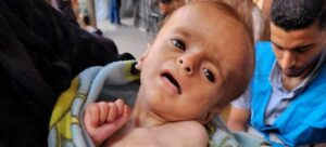 أوتشا): الحرمان جماعي وأطفال غزة جياع